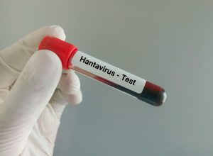 Investigarea unui caz suspect de hantavirus la Arad, cu implicarea autorităților sanitare
